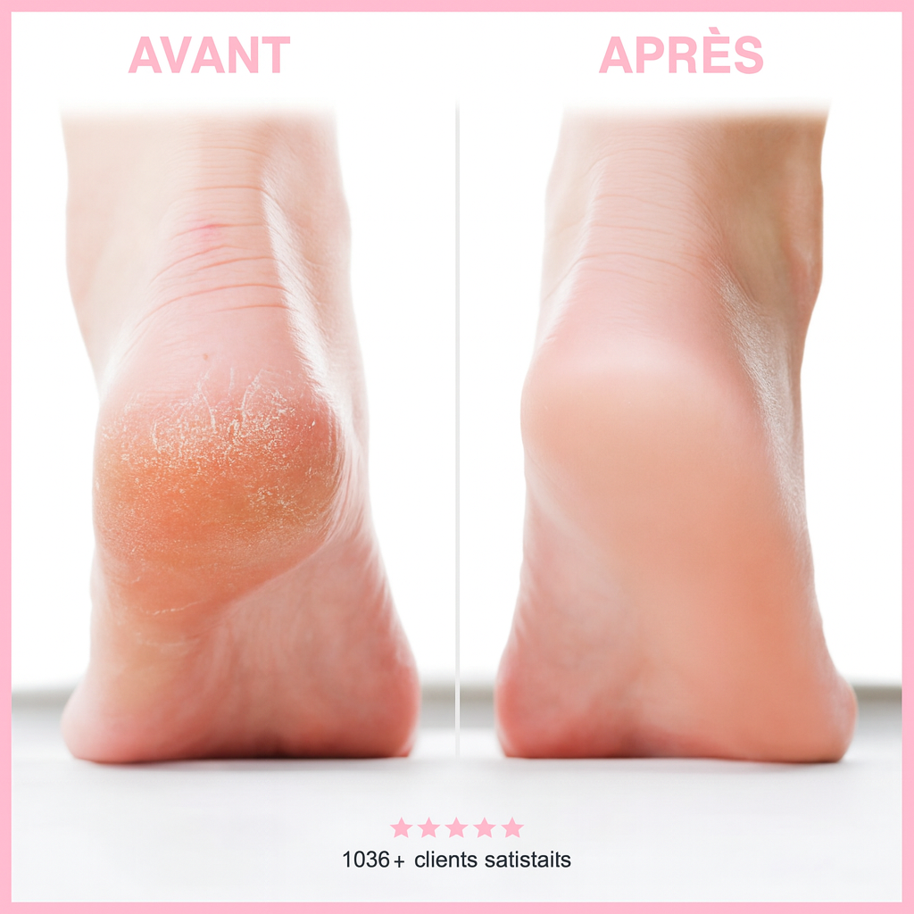 Blovanda Glow™ – Soin des Pieds
