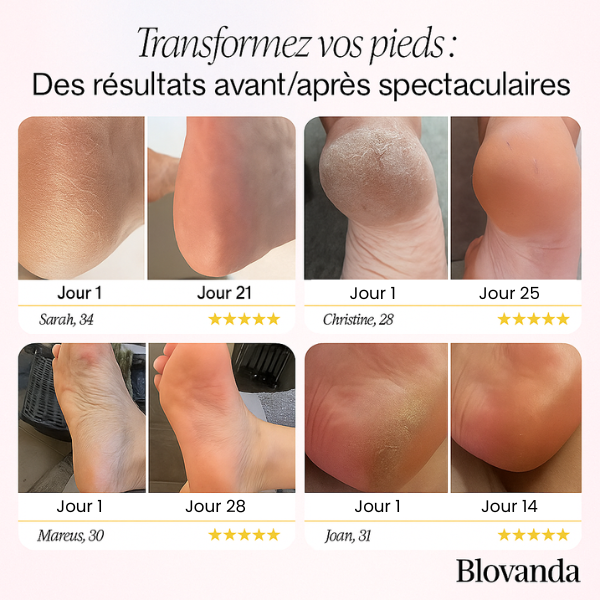 Blovanda Glow™ – Soin des Pieds
