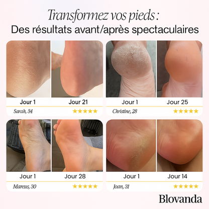 Blovanda Glow™ – Soin des Pieds